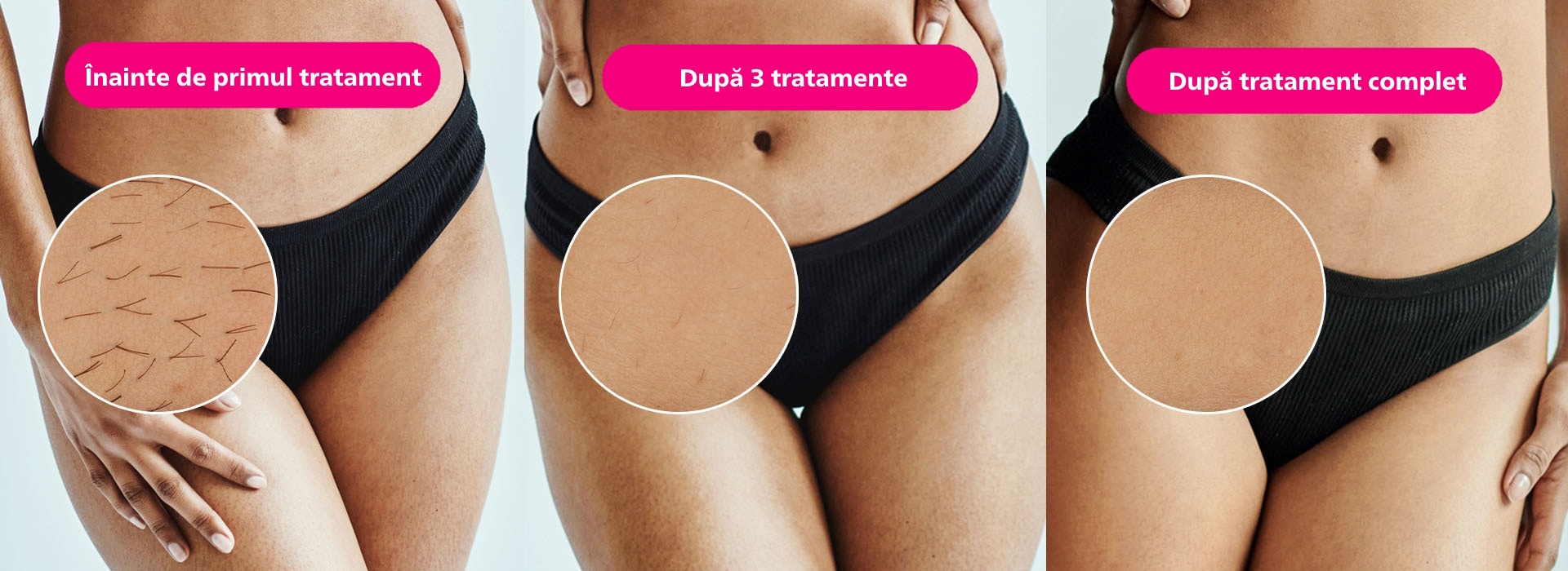 Rezultate Lumea bikini